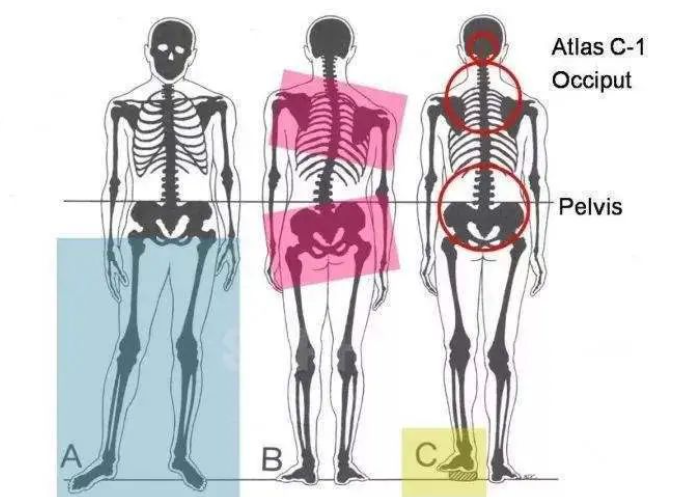 Different positions of the pelvis and spine