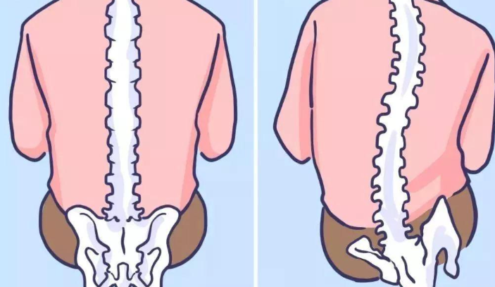 donut pillow helps you maintain correct posture